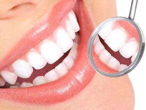 odontoiatria estetica cavaion