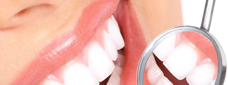 odontoiatria estetica cavaion