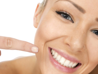 Sbiancamento dentale a Cavaion